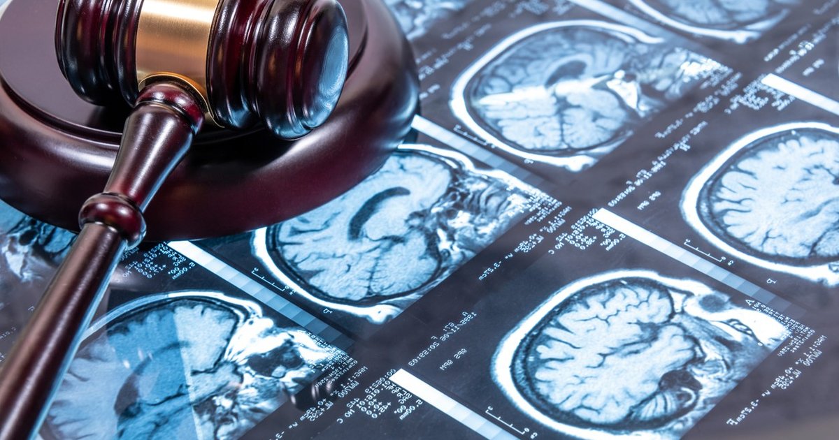 Ilustracao do tema legal envolvendo erro diagnostico em radiologia: cerebro e simbolos judiciais