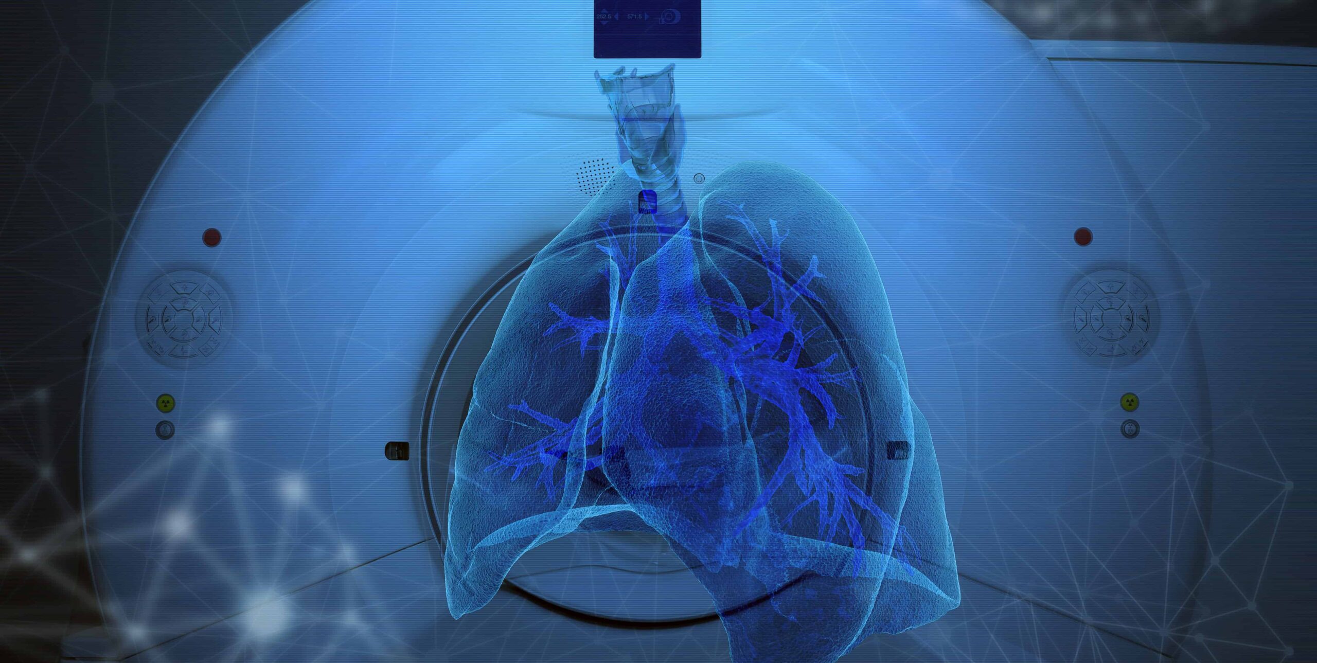 AI for PE Detection in CTPA: A Real Boost