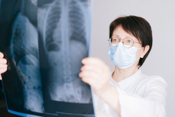 Radiologista analisa radiografia de torax com apoio de inteligencia artificial