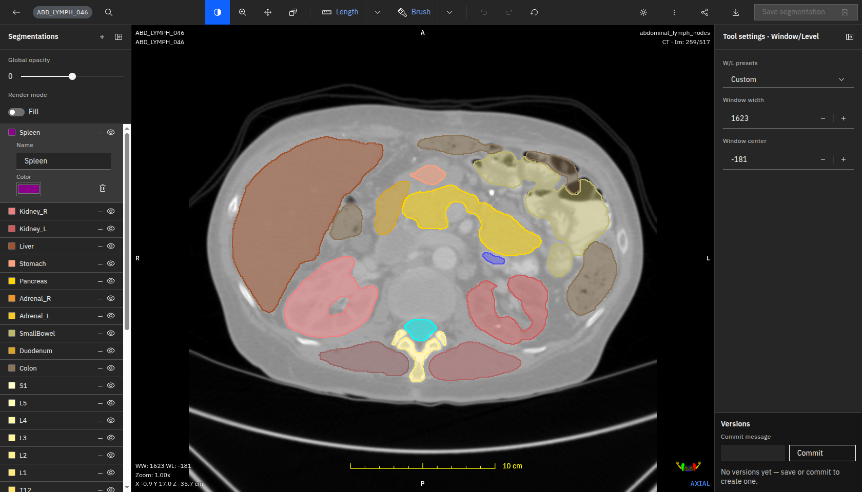 AutoSeg in-browser collaborative contouring editor
