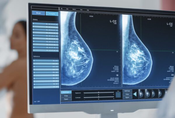 Mamografia de rastreamento analisada por inteligência artificial