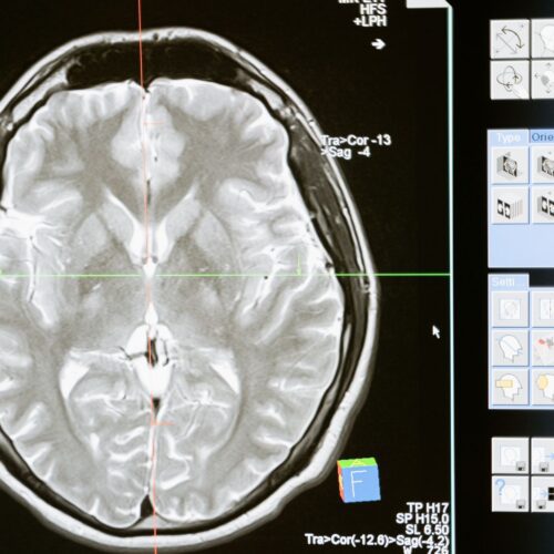 Bayer wins FDA nod for low-dose MRI contrast
