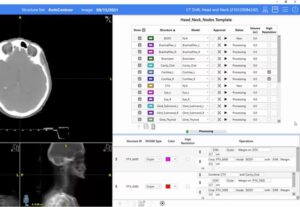 Radformation AutoContour interface (vendor screenshot)