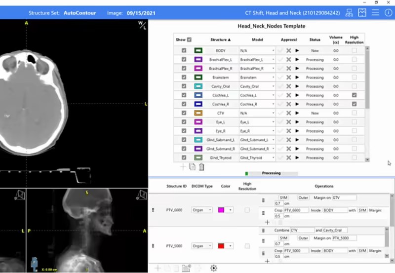 Radformation AutoContour interface