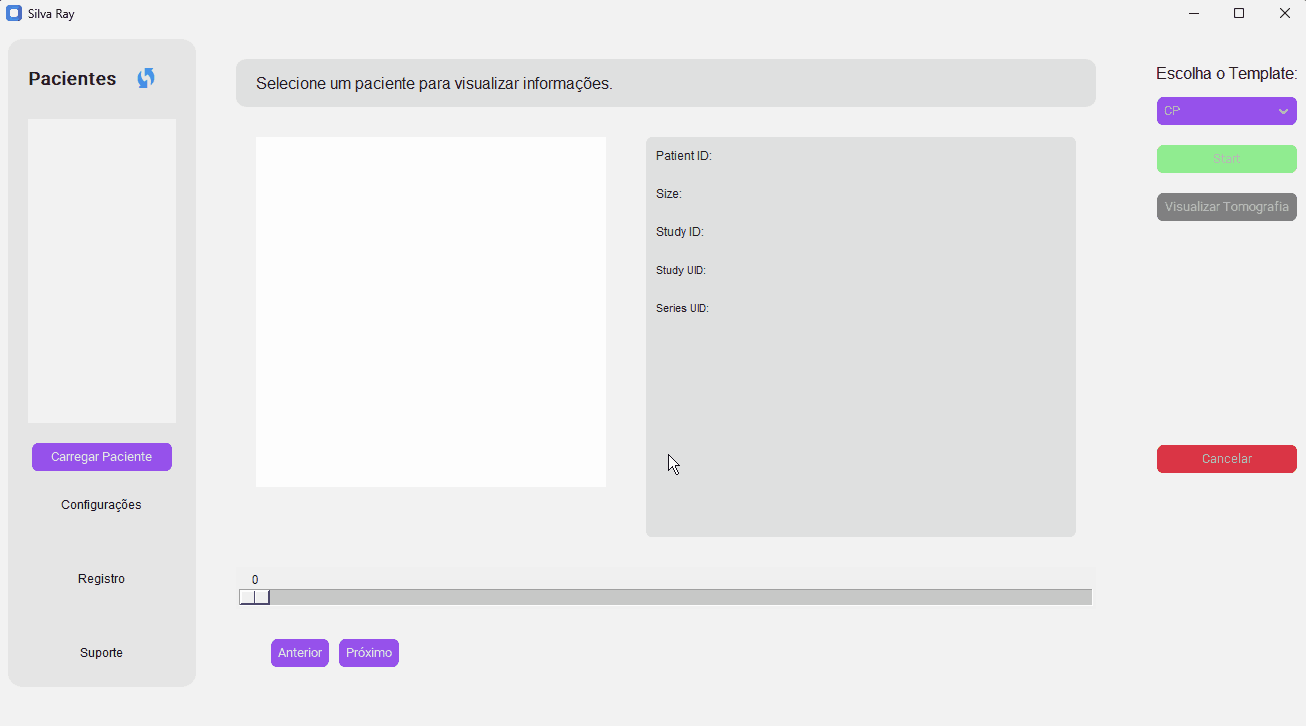SegmentaR (Silva Ray) interface