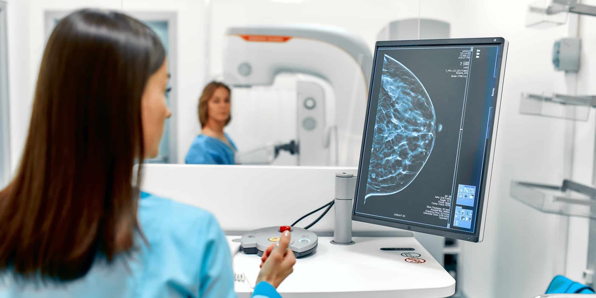 IA Rastrea la Evolución del Riesgo de Cáncer Mamario
