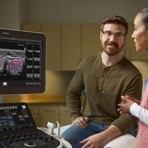 FDA autoriza el ecógrafo con IA Philips Alturion