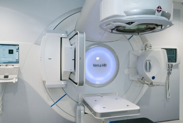 Acelerador linear usado em radioterapia estereotáxica corporal (SBRT)