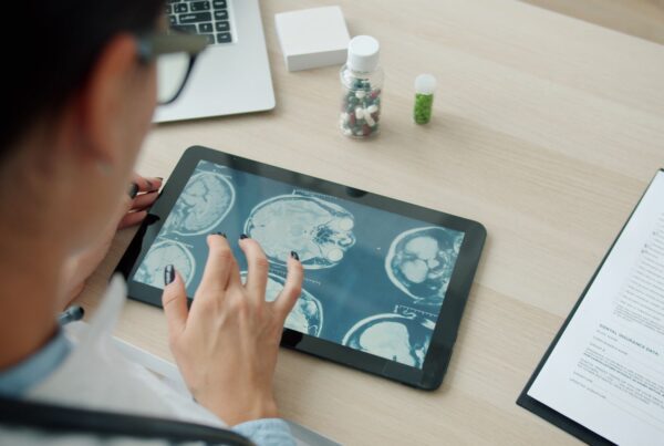 Medico revisando cortes de imagem cerebral em tablet a distancia, fora do hospital