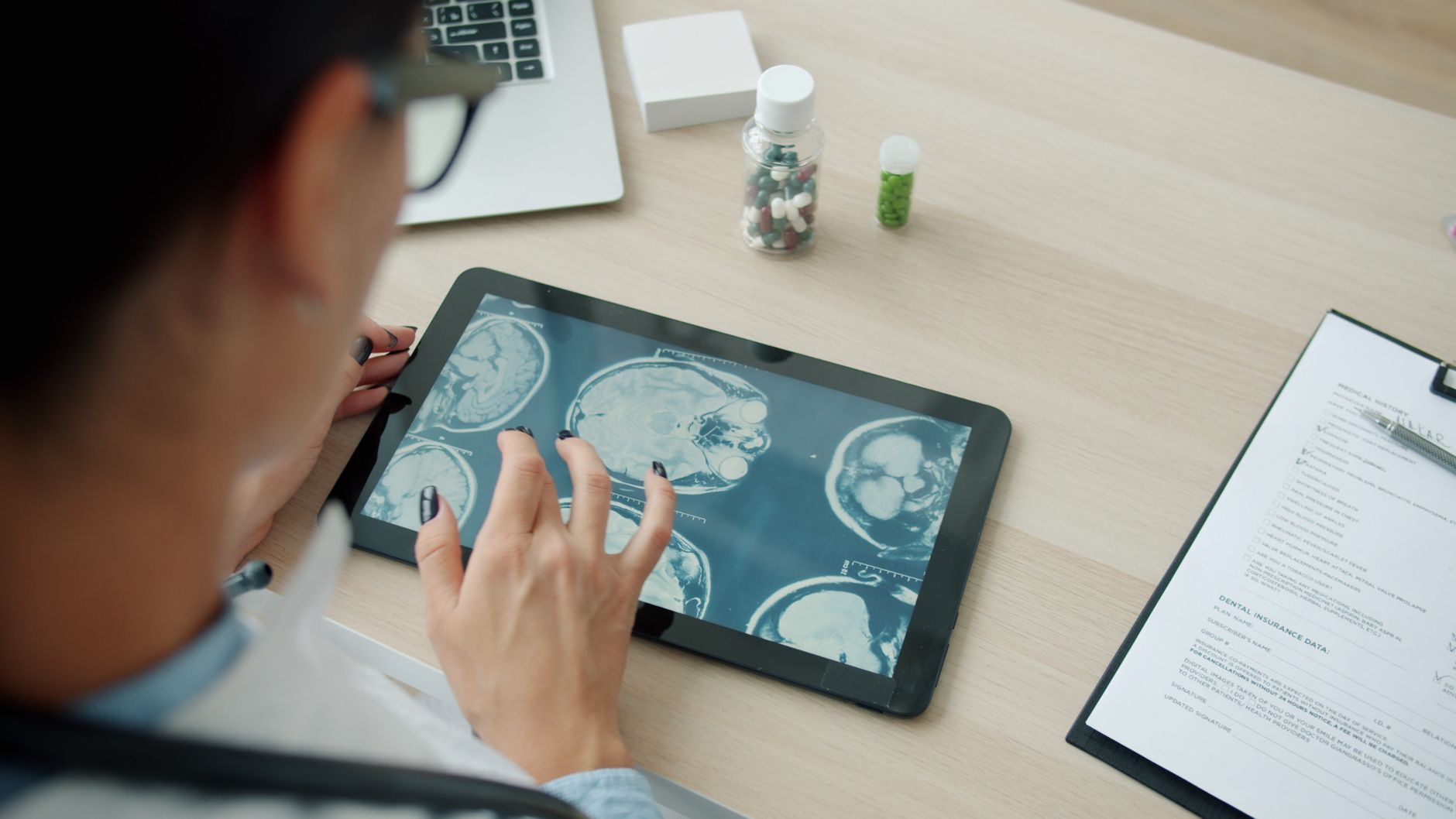 Physician reviewing brain imaging slices on a tablet away from the hospital, accessing the study remotely