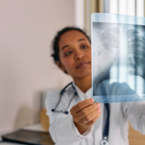 IA aponta pneumotórax que não existia no raio-X