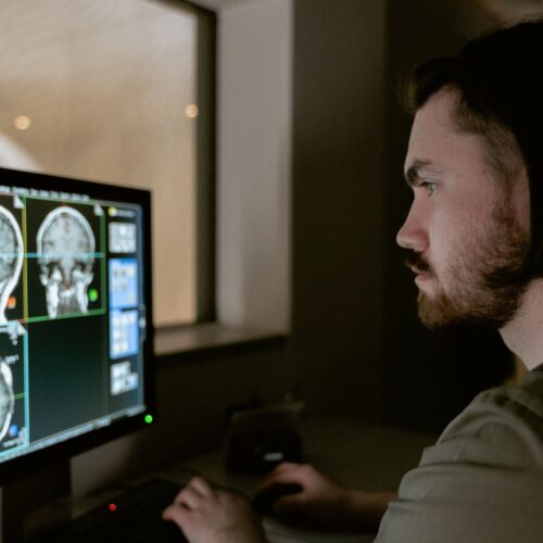 FDA Approves Lantheus Tau PET Agent for Alzheimer’s