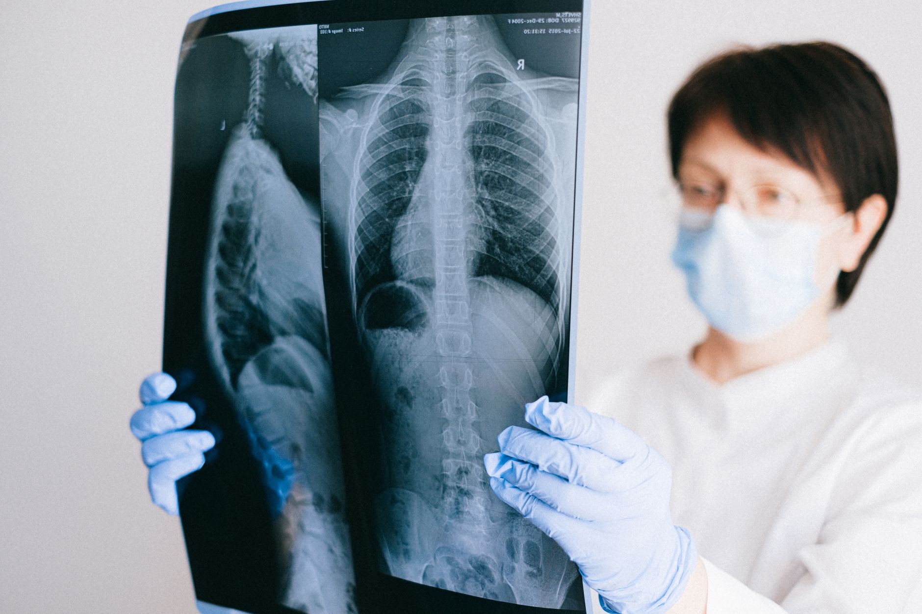 Médica examinando una radiografía de tórax con hallazgos pulmonares a contraluz