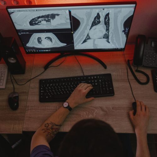 Radiologistas deixam o VA após veto ao teletrabalho