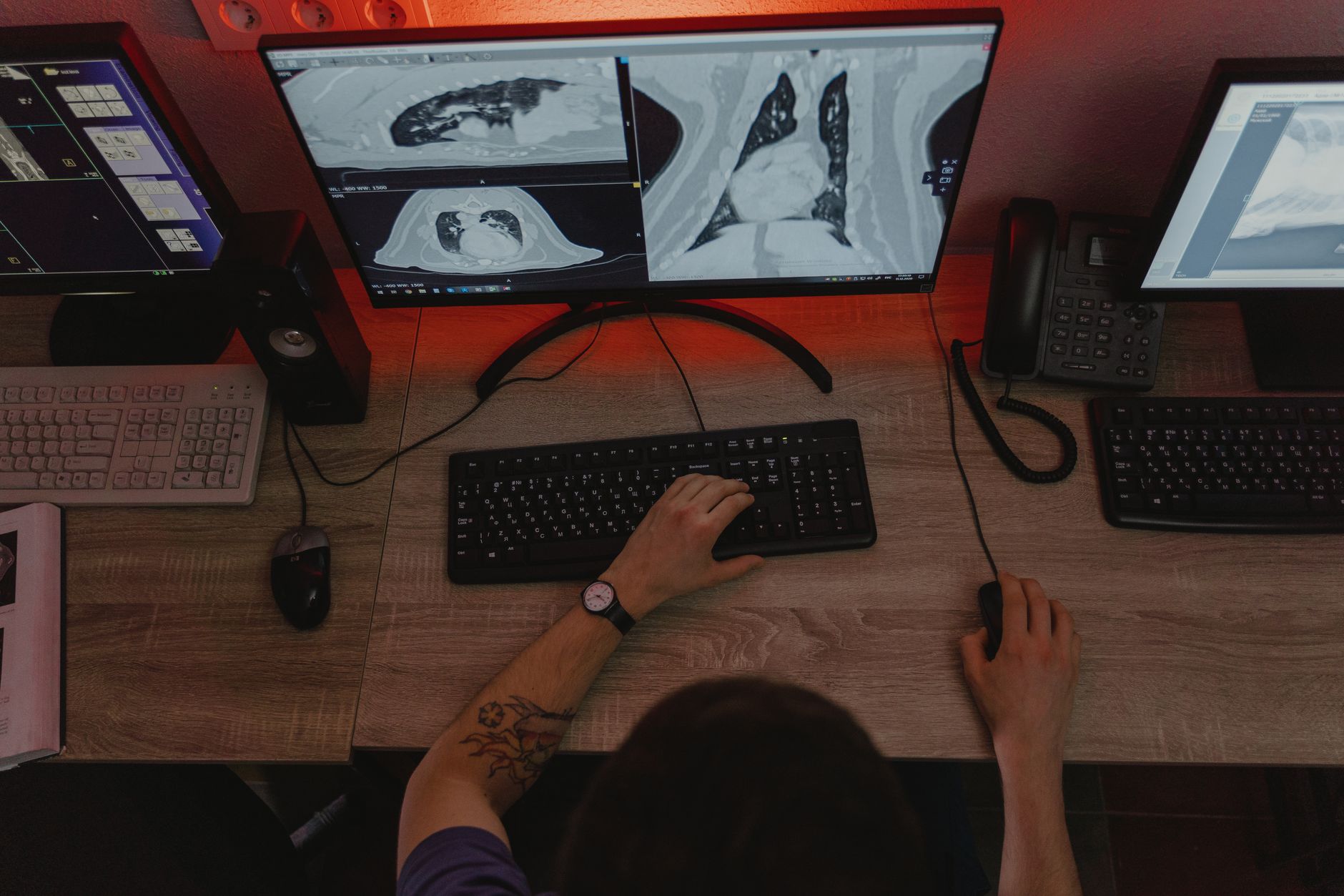 Radiologista analisa exames de imagem em múltiplos monitores em estação de laudo