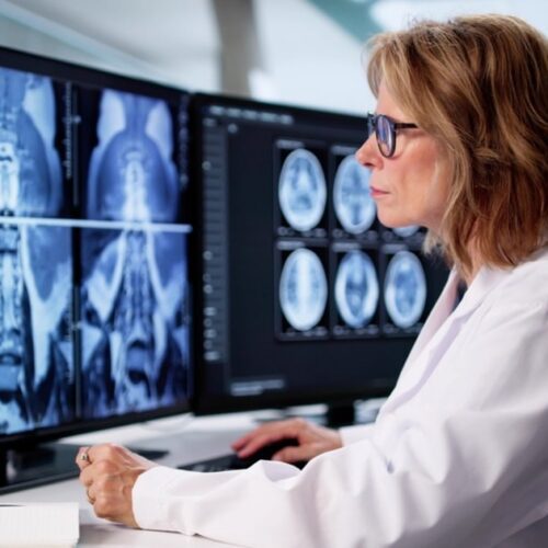 Radiologists Push Back on Whole-Body MRI Claims
