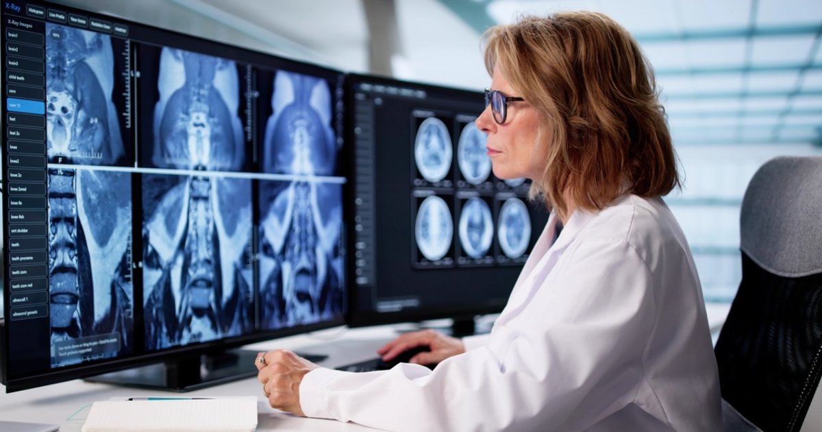 Radiologist reviewing a whole-body MRI examination across multiple diagnostic monitors