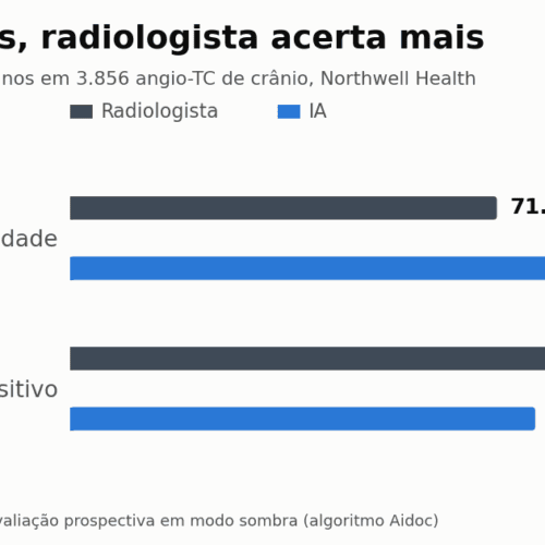 IA acha 39% mais aneurismas cerebrais na angio-TC