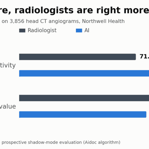 AI Finds 39% More Brain Aneurysms on CT Angiography