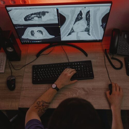 Monitor de laudo agora é ecossistema, não só tela