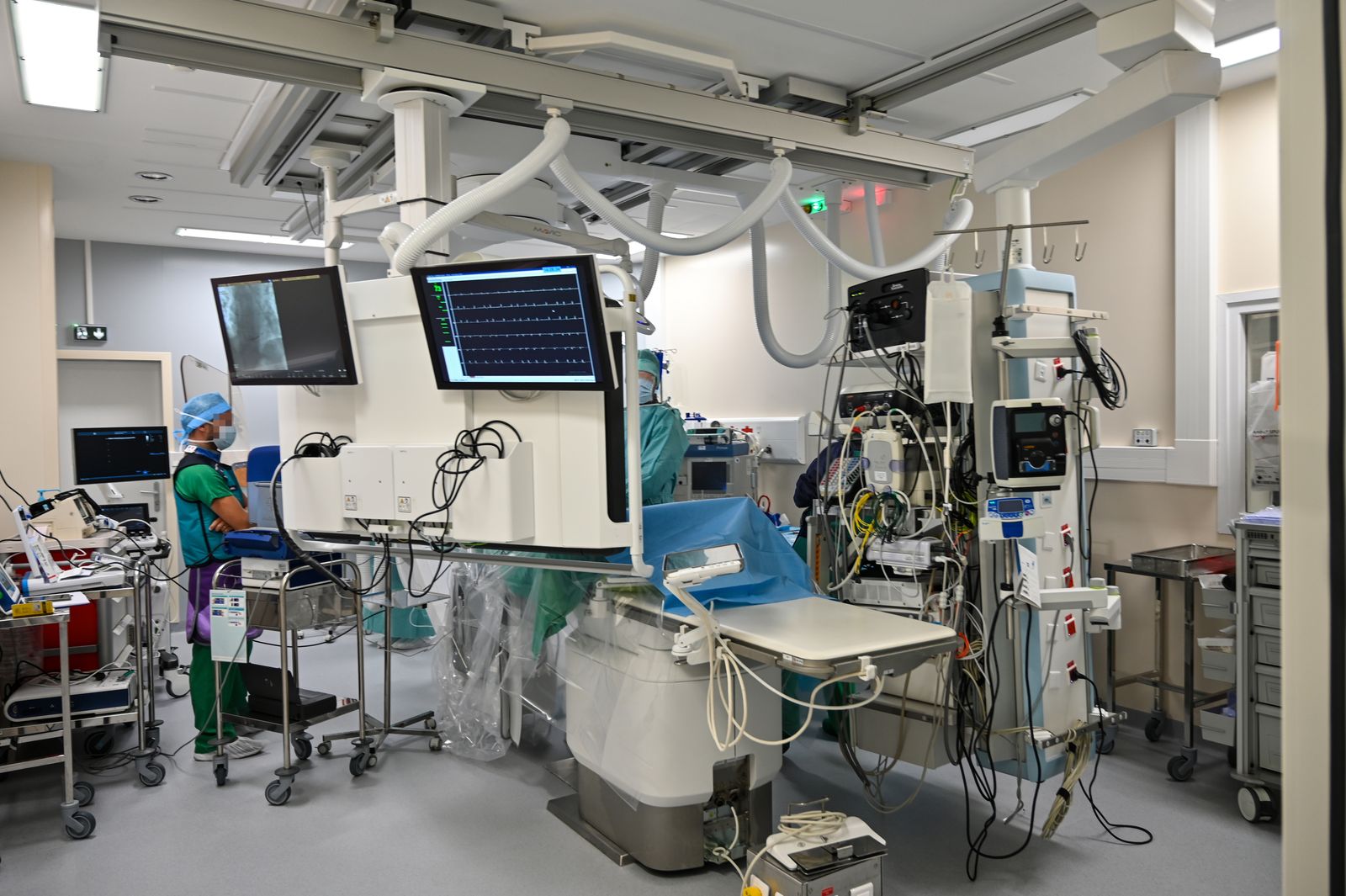 Sala de angiografía con arco en C y monitor de fluoroscopia, entorno típico de la embolización hepática