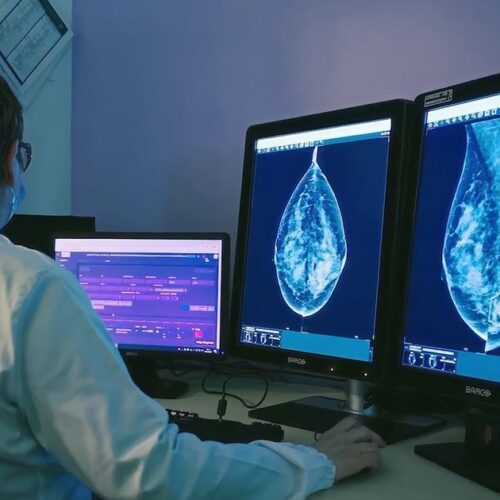 Estocolmo sustituye al 2.º lector de mamografía por IA