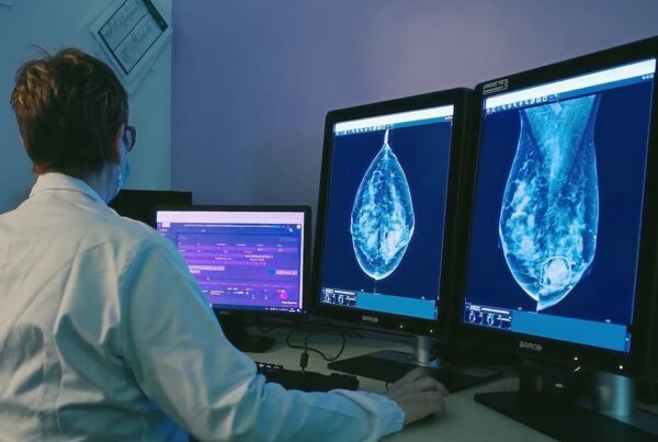 Radiologista analisa mamografias em monitores de diagnóstico com marcação de achado suspeito por IA