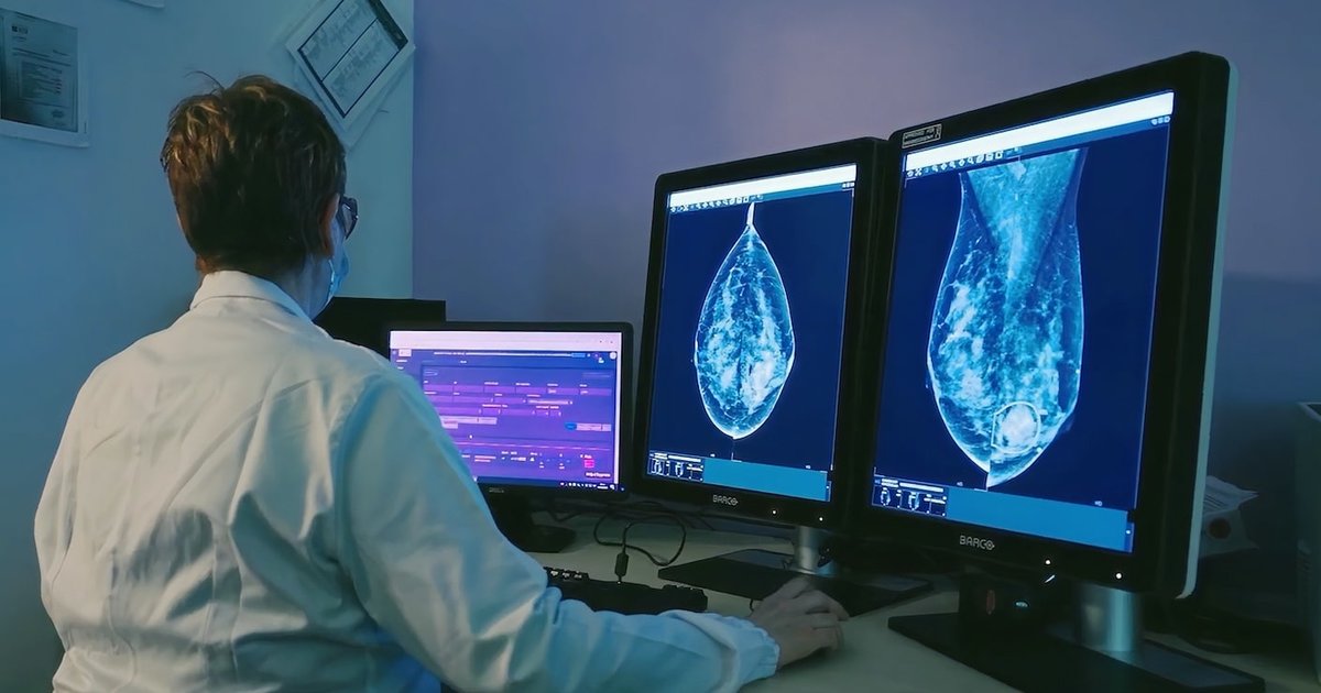 Radiologist reviewing mammograms on diagnostic monitors with an AI-marked suspicious finding