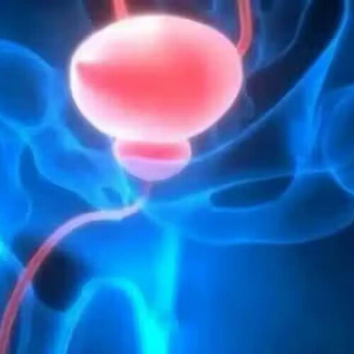 FDA otorga Fast Track a PET PSMA con RM prebiopsia