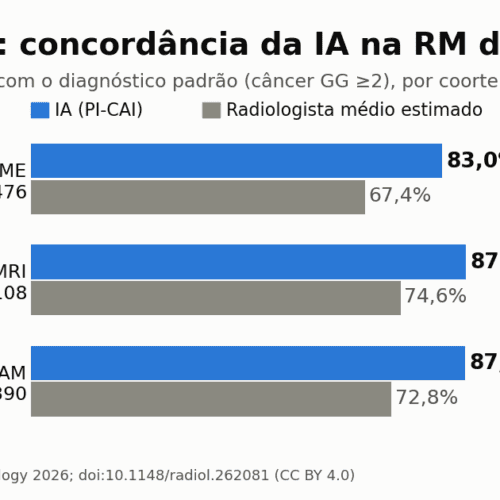 IA de código aberto iguala radiologistas na RM de próstata