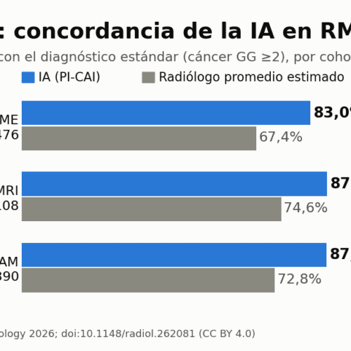 IA de código abierto iguala a radiólogos en RM de próstata