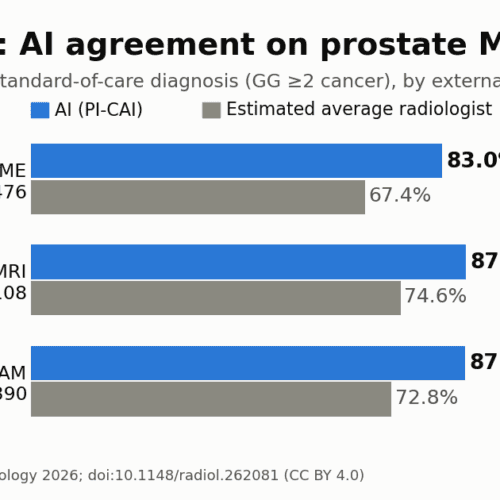 Open-Source AI Matches Radiologists on Prostate MRI Open-Source AI Matches Radiologists on Prostate MRI